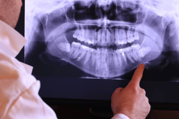 Best Emergency Treatment for Dental Infections or Abscesses in Prospect, PA